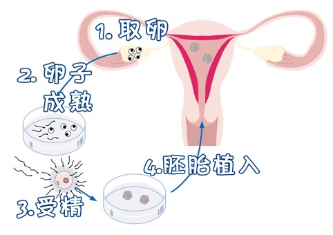 助孕儿子包成功